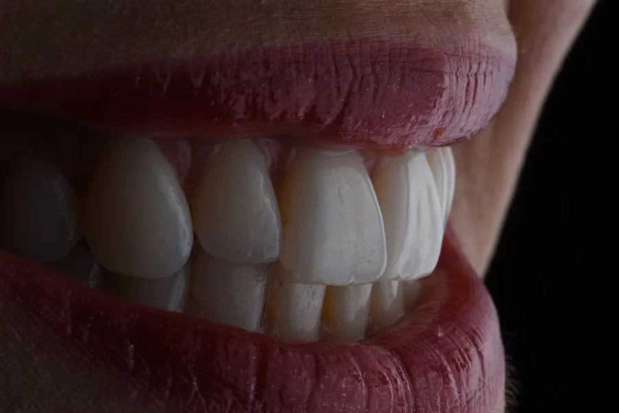 Healthy Smiles Dental - Las Vegas Dentist Picture 3