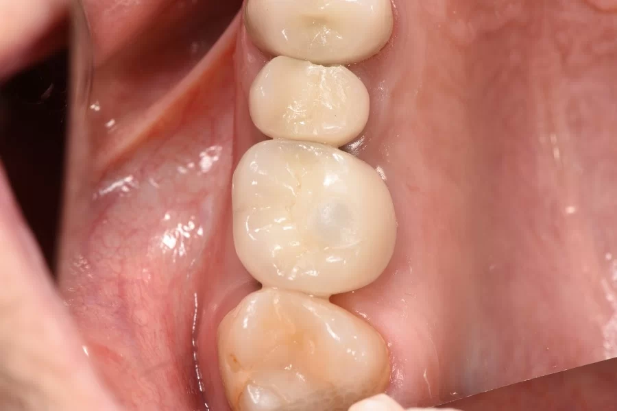 Healthy Smiles Dental - Las Vegas Dentist Picture 1