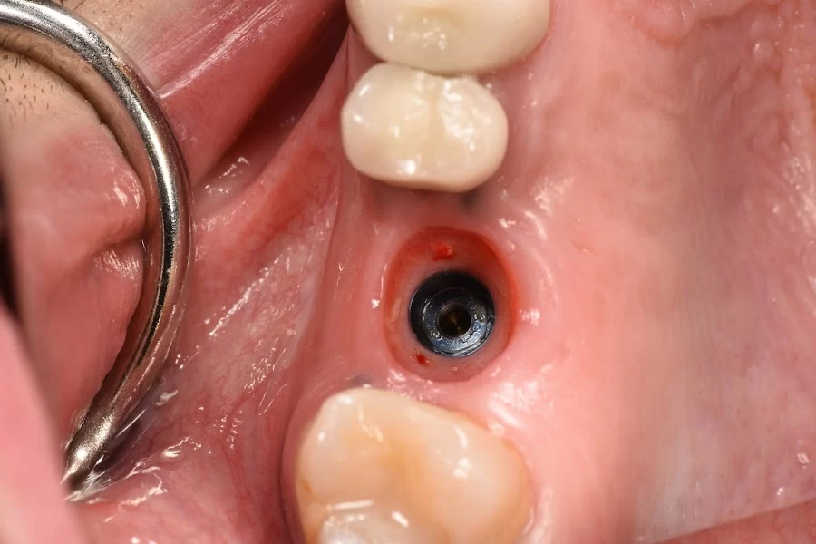 Healthy Smiles Dental - Las Vegas Dentist Picture 7