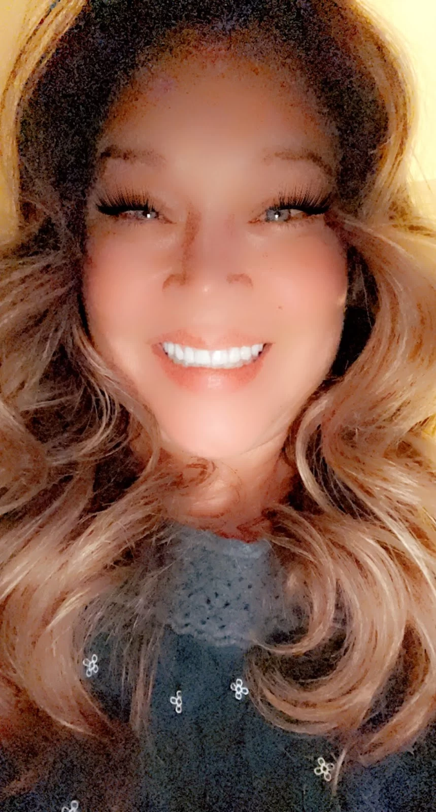 Healthy Smiles Dental - Las Vegas Dentist Picture 10
