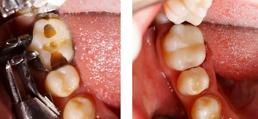 Okun Dentistry - Mesa Picture 6