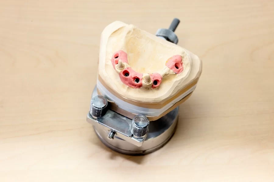 Okun Dentistry - Mesa Picture 4