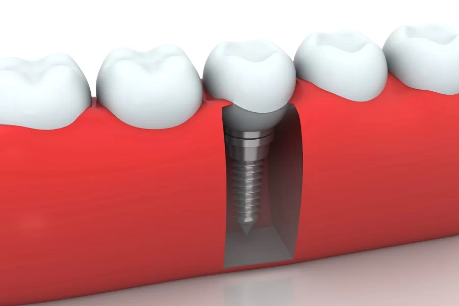 Okun Dentistry - Mesa Picture 3