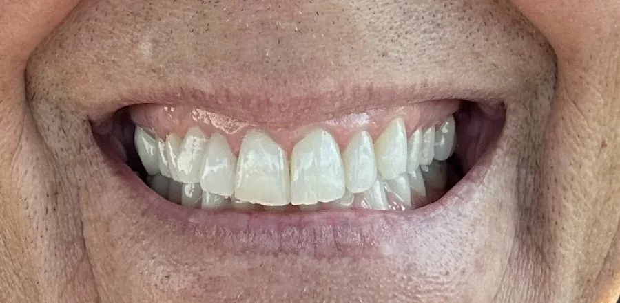 Aspen Dental - Mesa, AZ Picture 2
