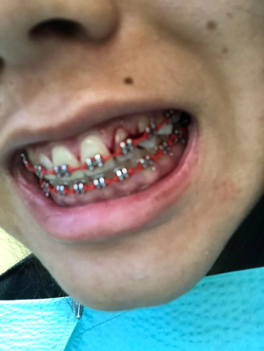 Simon Dental Care Picture 5