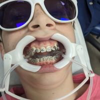MyOrthodontist Cary ico