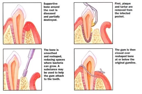 Cary Periodontics and Implant Dentistry Picture 6