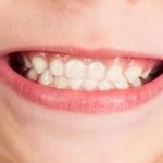 Papania Family Dentistry