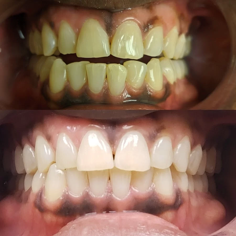 Dr. Kiono L. Barnes, DMD, Dental Concepts Picture 5