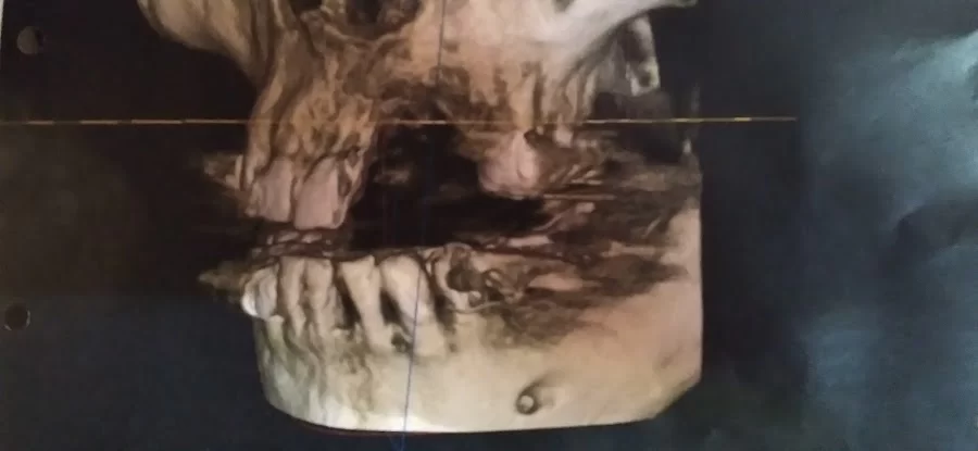 Rick Lacuesta, DDS Picture 1