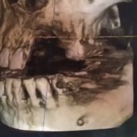 Rick Lacuesta, DDS ico