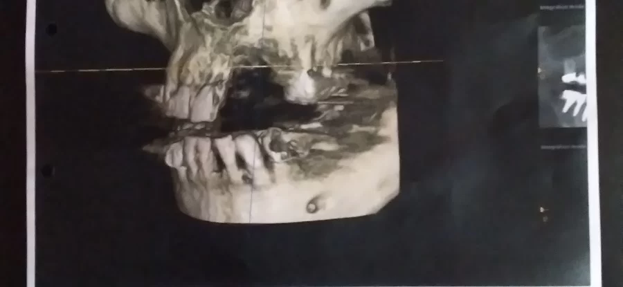 Rick Lacuesta, DDS Picture 2