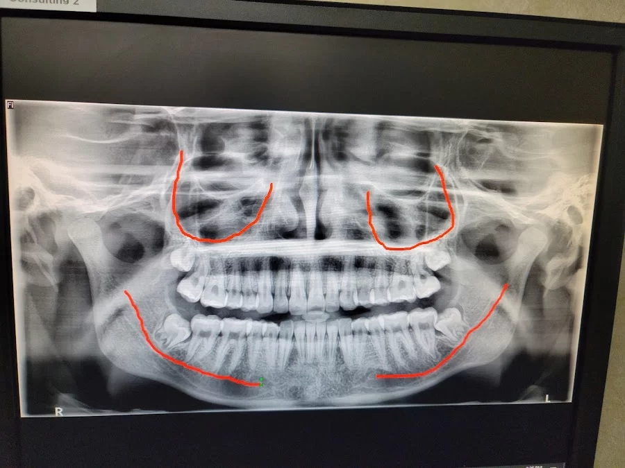 Fish and Sarhangian Oral and Maxillofacial Surgery Picture 1
