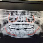 Fish and Sarhangian Oral and Maxillofacial Surgery