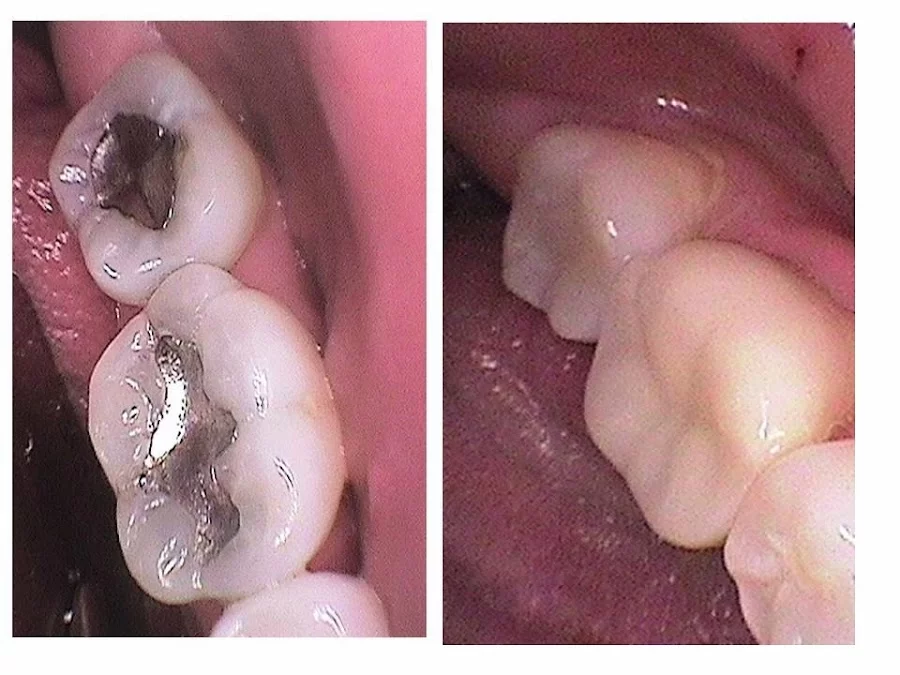 Justin L. Beasley, DDS Picture 6