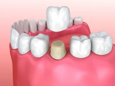 John A. Garza DDS, LVIF, FIAPA, BSC Picture 1