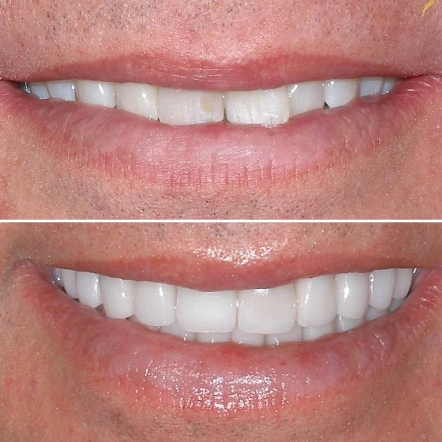 John A. Garza DDS, LVIF, FIAPA, BSC Picture 10
