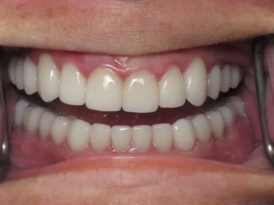 Wilkinson Dental Picture 4