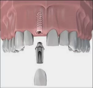 Dr Ed DeAndrade : Anthem Periodontics and Dental Implants Picture 3