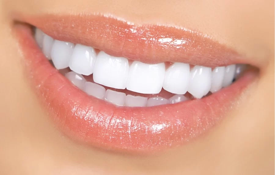 Summerlin Dental Solutions Picture 2
