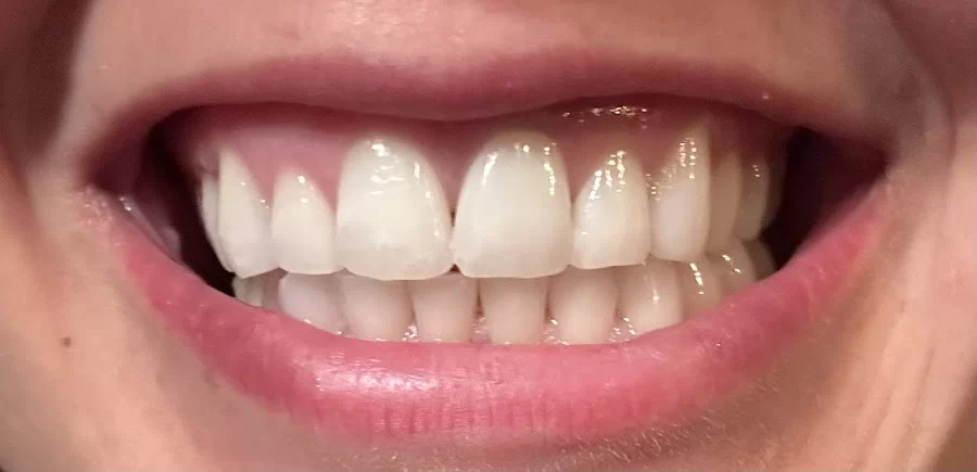 Kerr Endodontics Picture 1