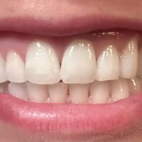 Kerr Endodontics ico