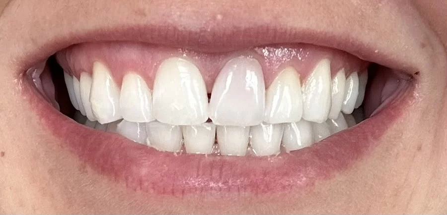 Kerr Endodontics Picture 2