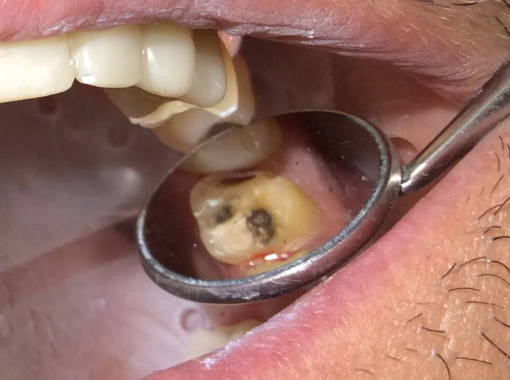 Dee for Dentist Picture 8