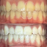 We Whiten ico