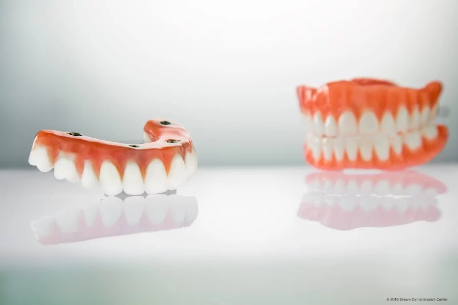 Dream Dental Implant Center Picture 1