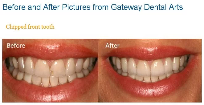 Gateway Dental Arts Picture 2