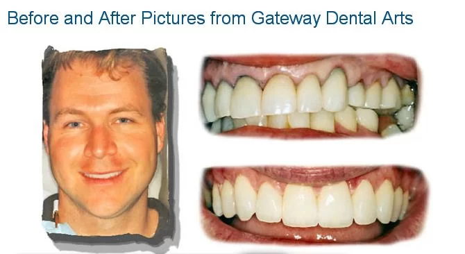 Gateway Dental Arts Picture 6