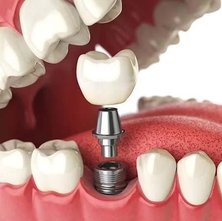 Holladay Hills Dental Picture 1