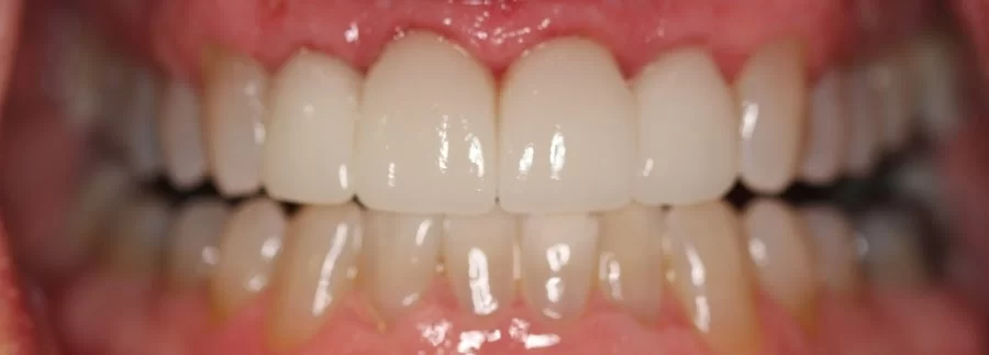 Timmons Cosmetic and Implant Dentistry Picture 1