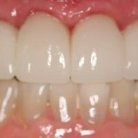 Timmons Cosmetic and Implant Dentistry ico