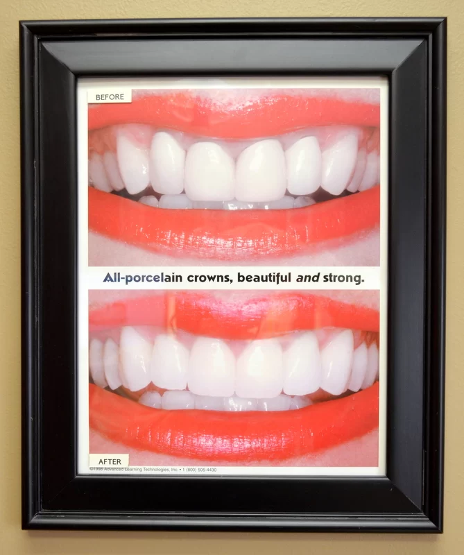 Timmons Cosmetic and Implant Dentistry Picture 10