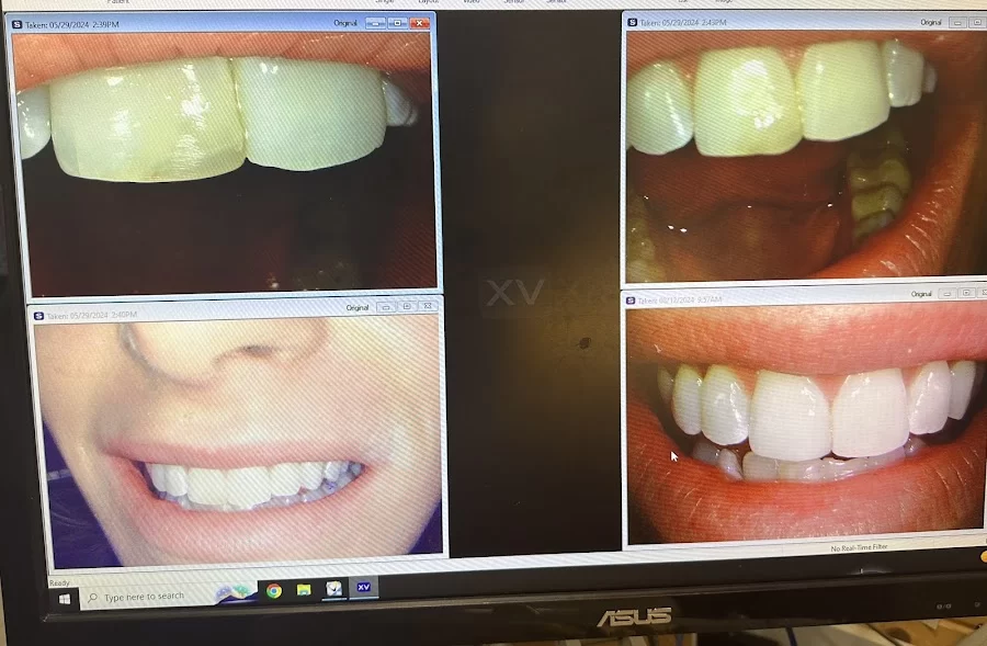 Health Sense Dental Picture 2