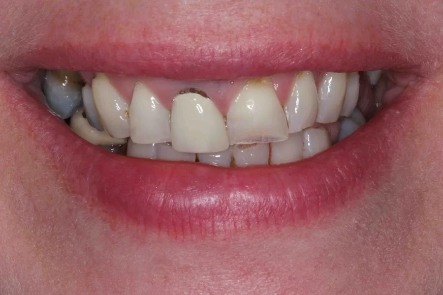 Allison Jarrett, DDS Picture 5
