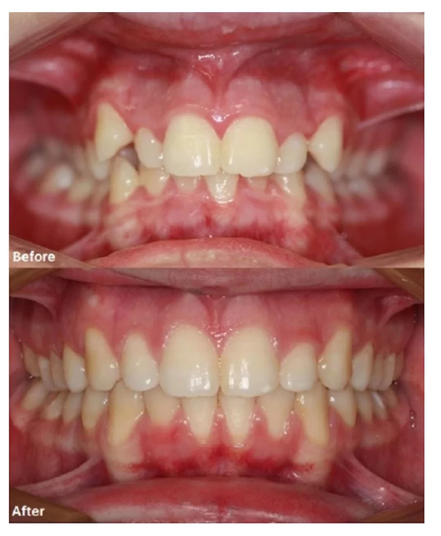 A Winning Smile Orthodontics Picture 5