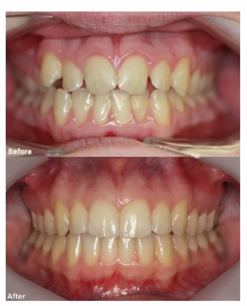 A Winning Smile Orthodontics Picture 6