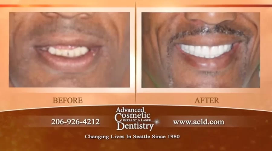 Advanced Cosmetic and Implant Dentistry Picture 6