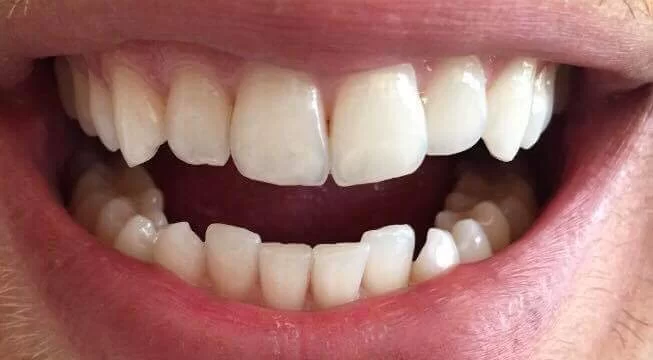 Somerset Dental Professionals LLC Picture 1