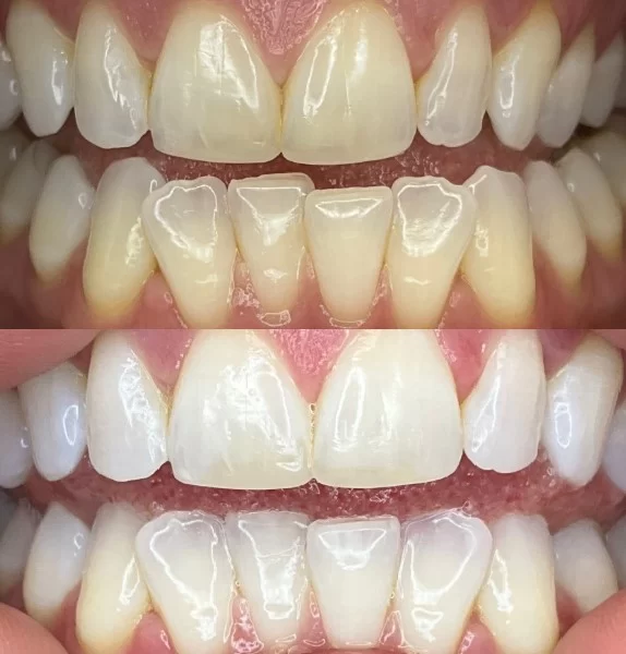 We Whiten Picture 1
