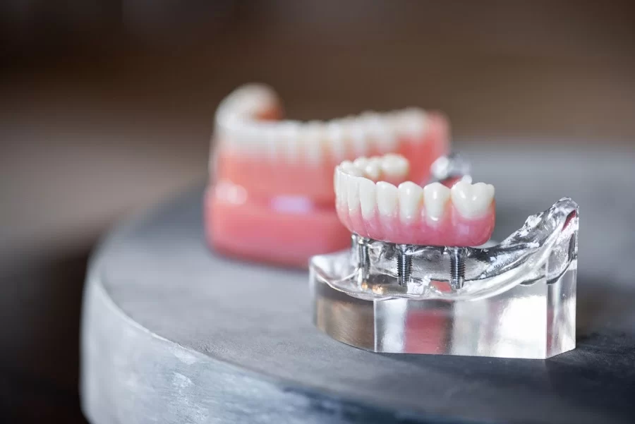 Stoner Periodontic & Implant Specialists - Dublin Picture 2