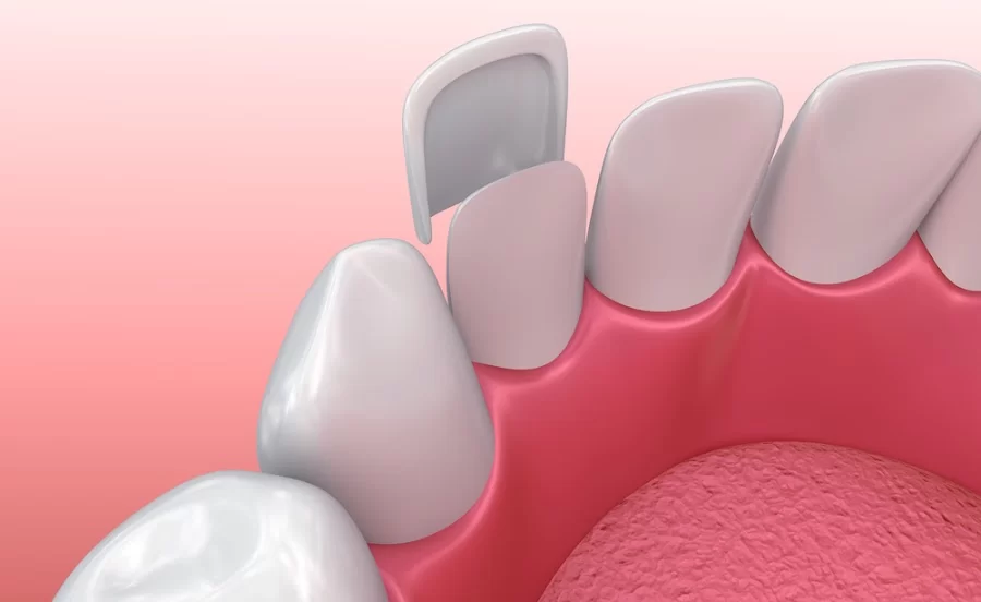 Auburndale Dental Newton Picture 2