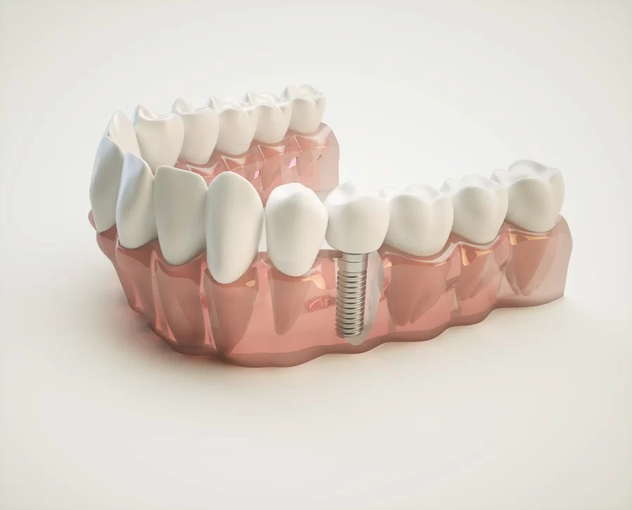 Auburndale Dental Newton Picture 1