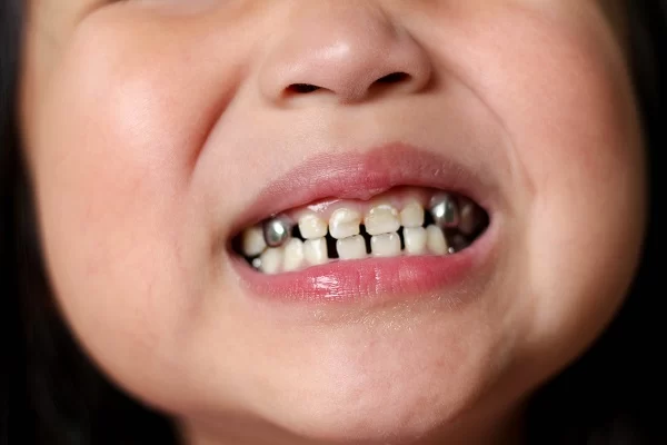 Smile Center Picture 1