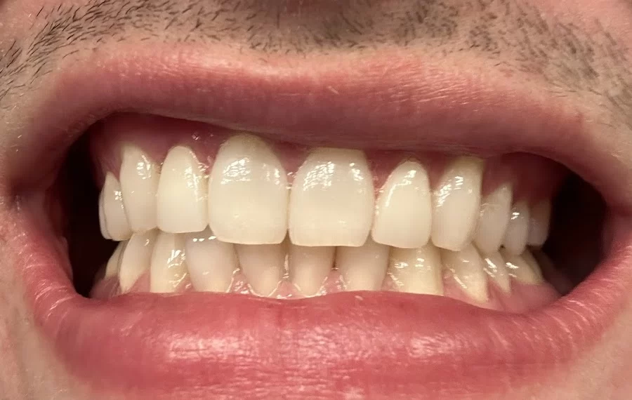 Willowview Dental Care Picture 1