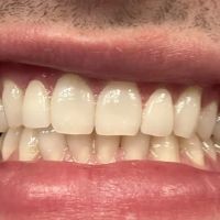 Willowview Dental Care ico