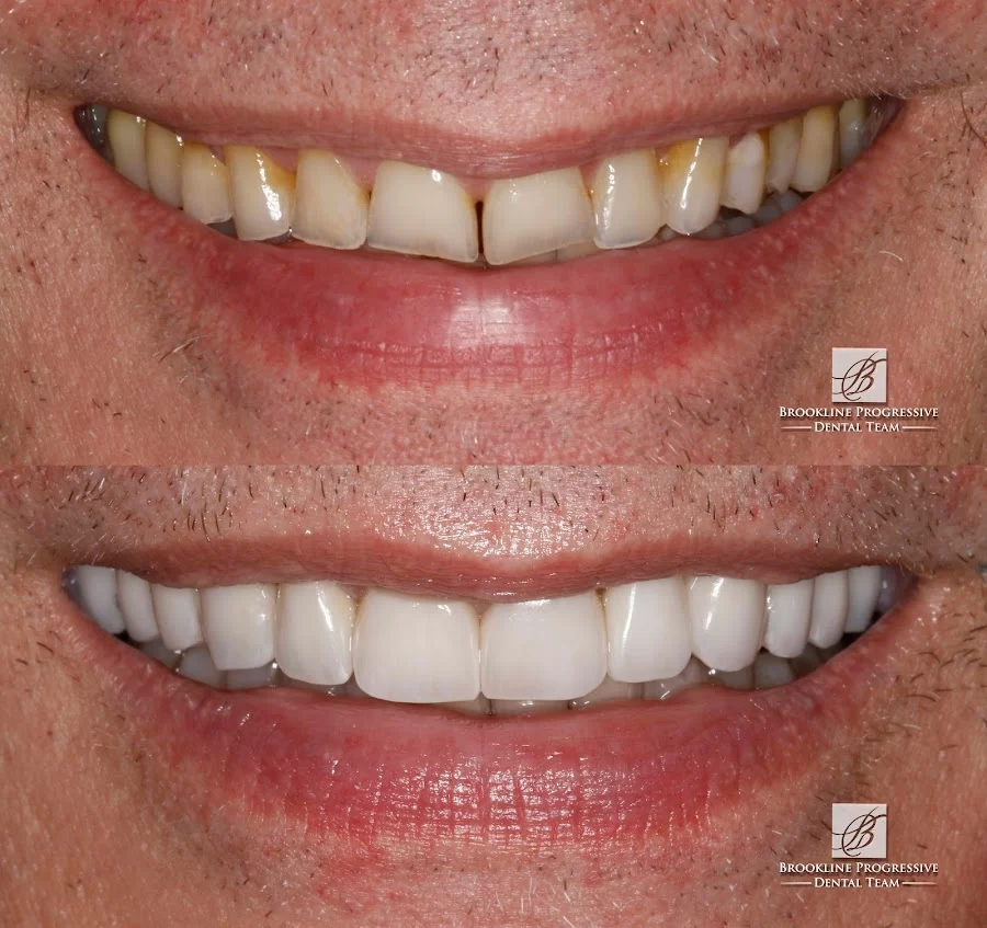 Brookline Progressive Dental Team Picture 9